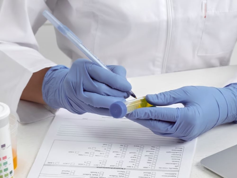 Does CBD show up on drug tests? Home